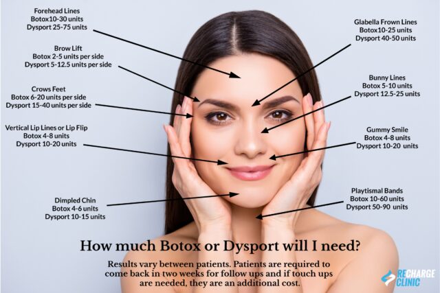botox and dysport neurotoxins