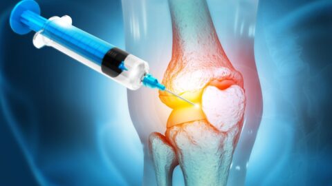 PRP Therapy