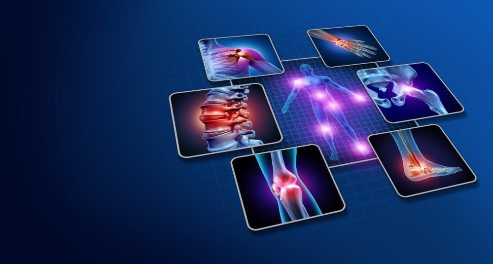 PRP Therapy