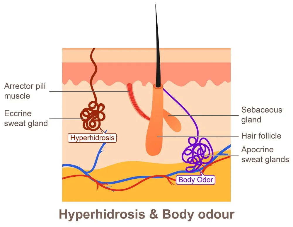 sweat glands understanding body oder