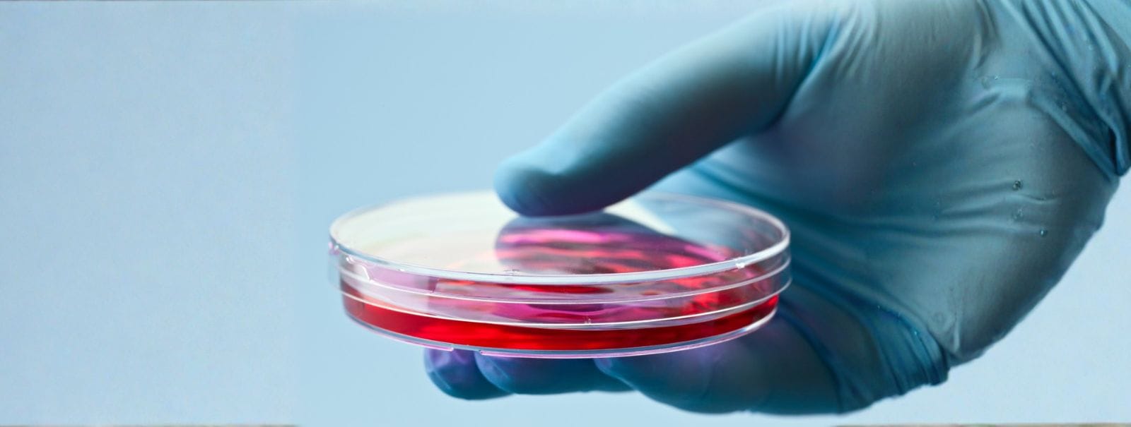 stem cells